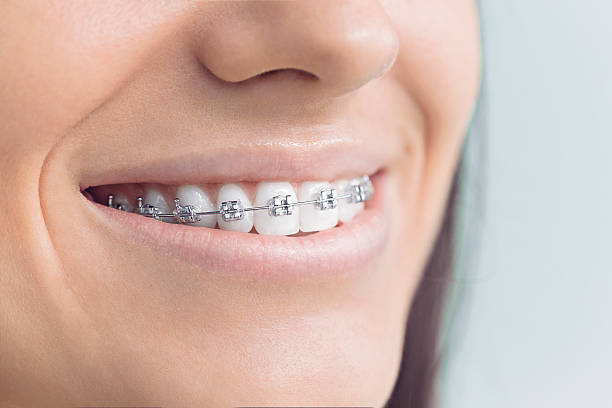 Full Mouth Reconstruction in Upper Saddle River, NJ